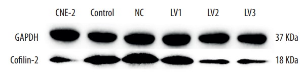 Western blot analysis showing cofilin-2 protein expression in different groups.jpg